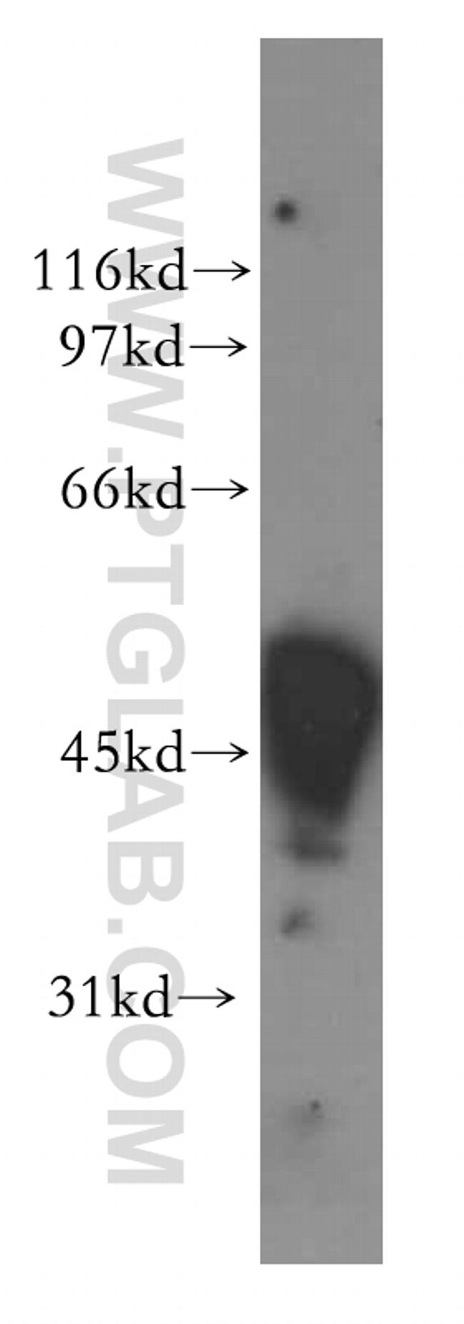 GATM Antibody in Western Blot (WB)