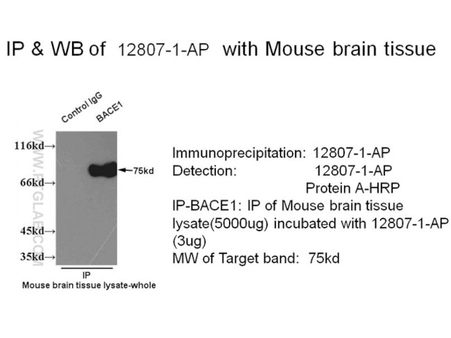 BACE1 Antibody in Immunoprecipitation (IP)