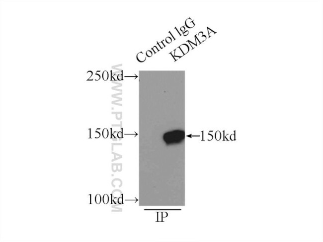 KDM3A/JMJD1A Antibody in Immunoprecipitation (IP)