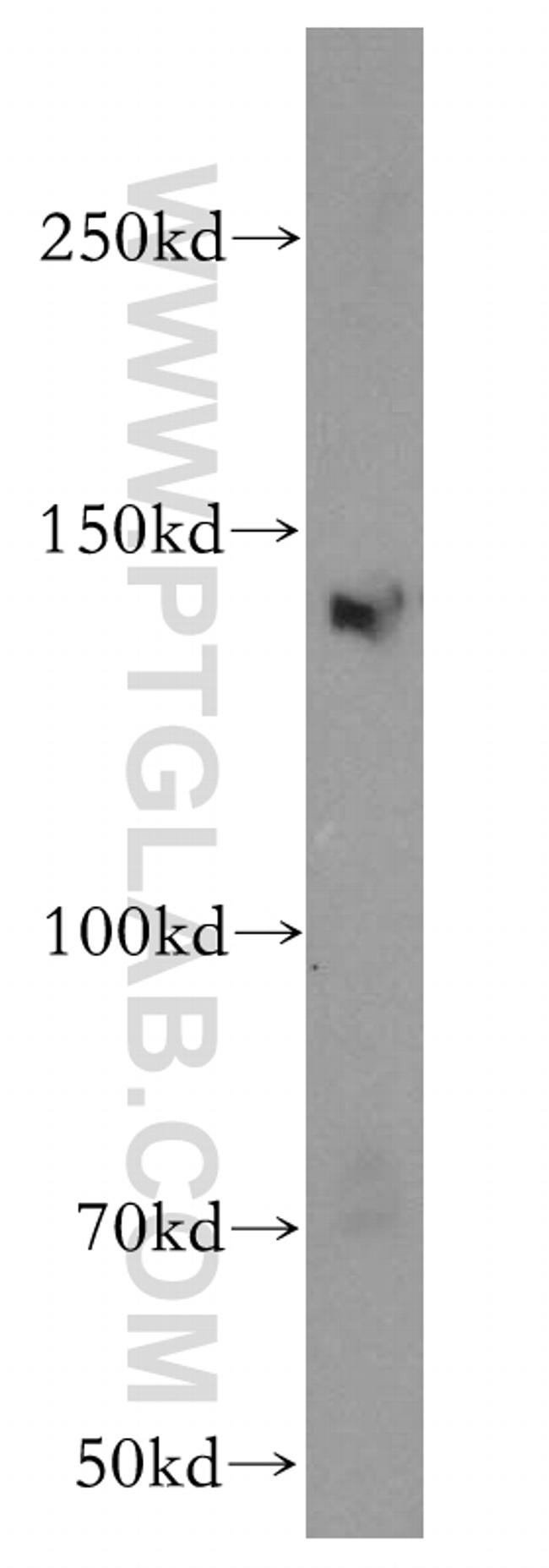 KDM3A/JMJD1A Antibody in Western Blot (WB)