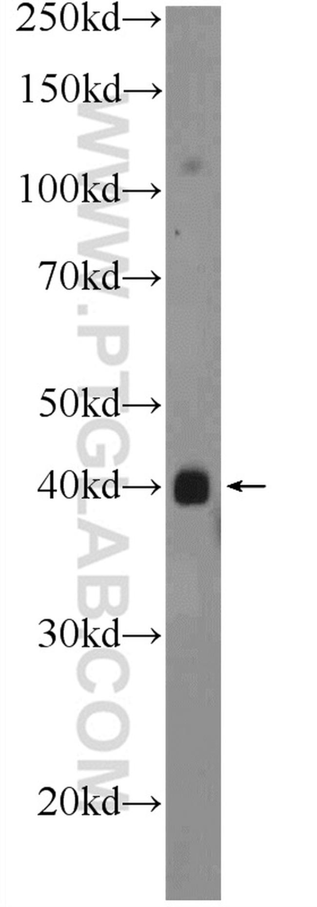 PHC2 Antibody in Western Blot (WB)
