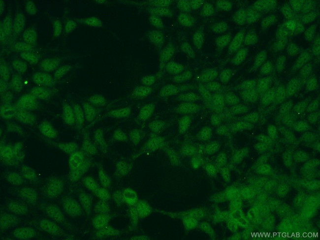 NUDT16 Antibody in Immunocytochemistry (ICC/IF)
