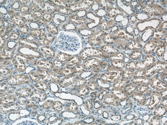 NUDT16 Antibody in Immunohistochemistry (Paraffin) (IHC (P))