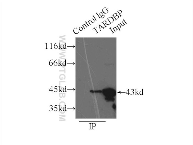 TDP-43 (C-terminal) Antibody in Immunoprecipitation (IP)