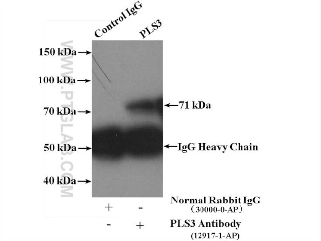 PLS3 Antibody in Immunoprecipitation (IP)