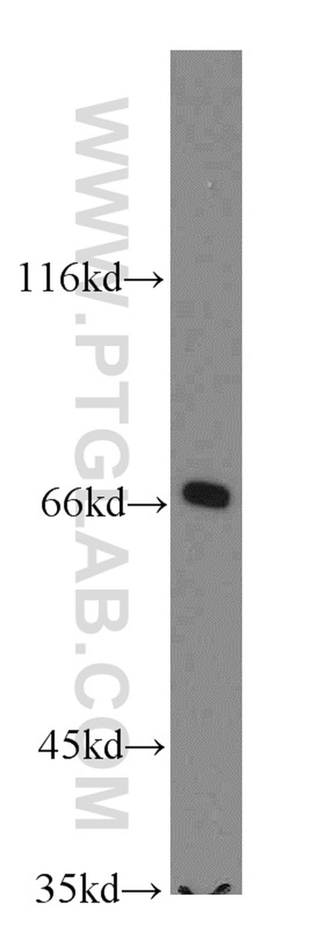SLC27A3 Antibody in Western Blot (WB)
