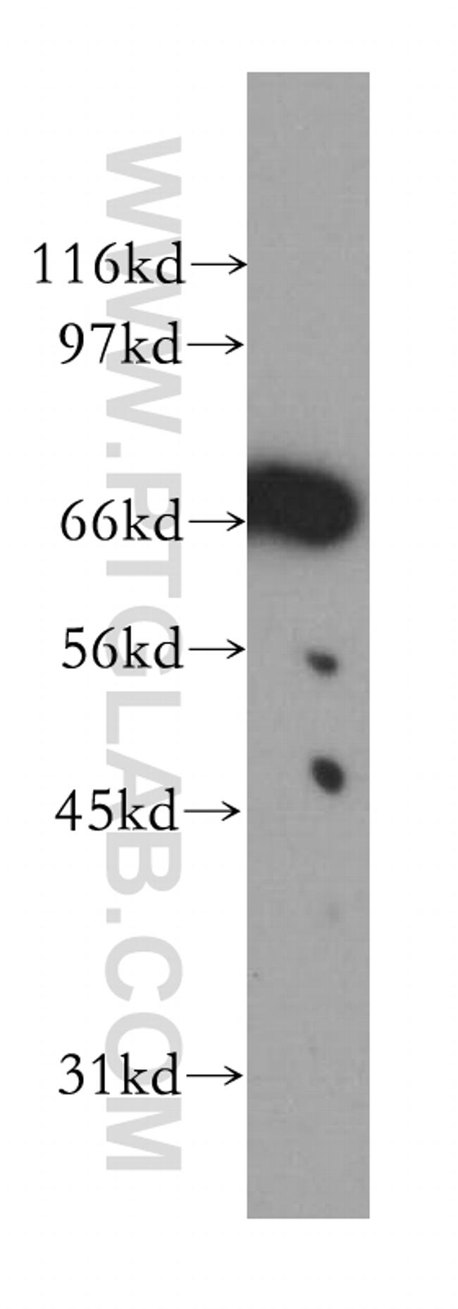 Lamin B1 Antibody in Western Blot (WB)