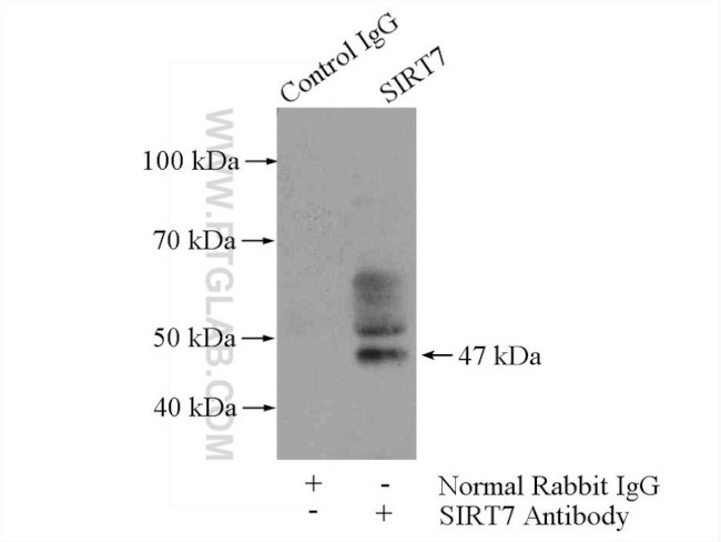 SIRT7 Antibody in Immunoprecipitation (IP)