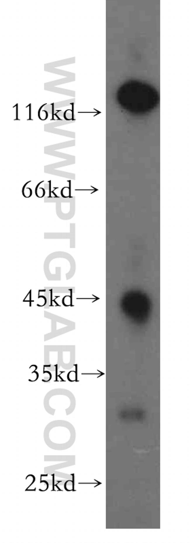 SIRT7 Antibody in Western Blot (WB)