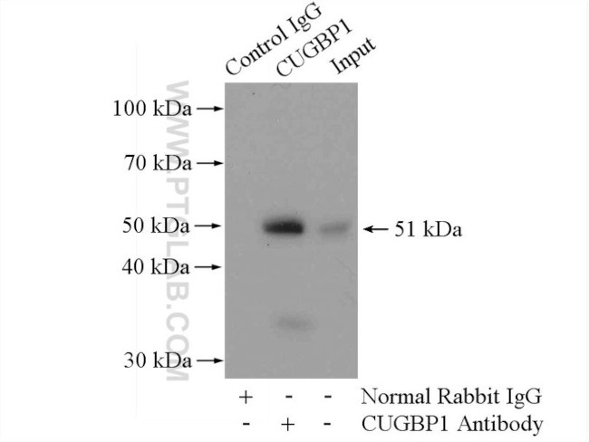 CUGBP1 Antibody in Immunoprecipitation (IP)