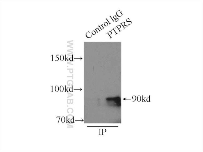 PTPRS Antibody in Immunoprecipitation (IP)