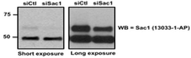 SACM1L Antibody in Western Blot (WB)
