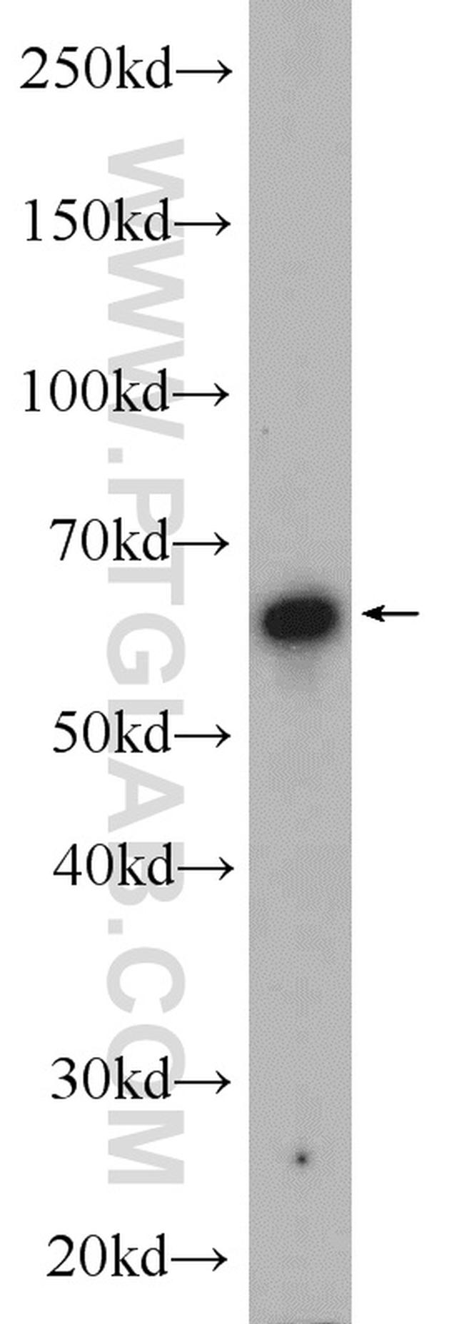 SACM1L Antibody in Western Blot (WB)