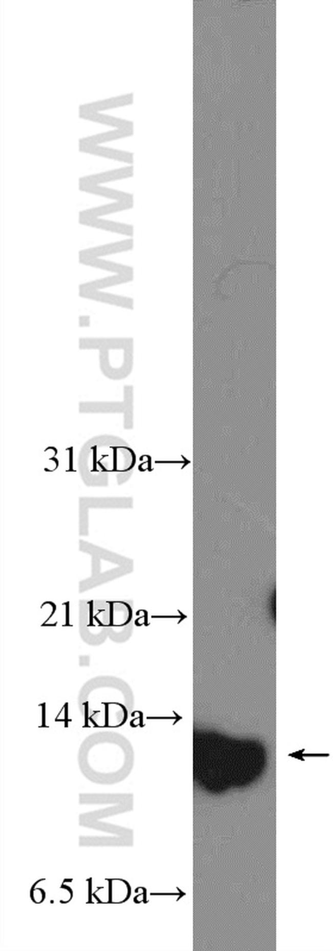 S100A7/Psoriasin Antibody in Western Blot (WB)