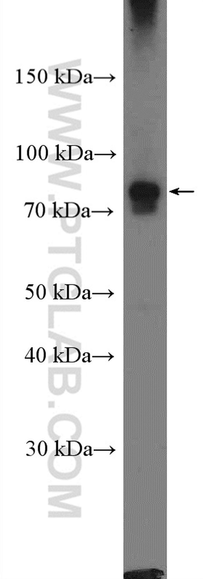 NUP93 Antibody in Western Blot (WB)