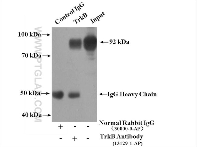 TrkB Antibody in Immunoprecipitation (IP)