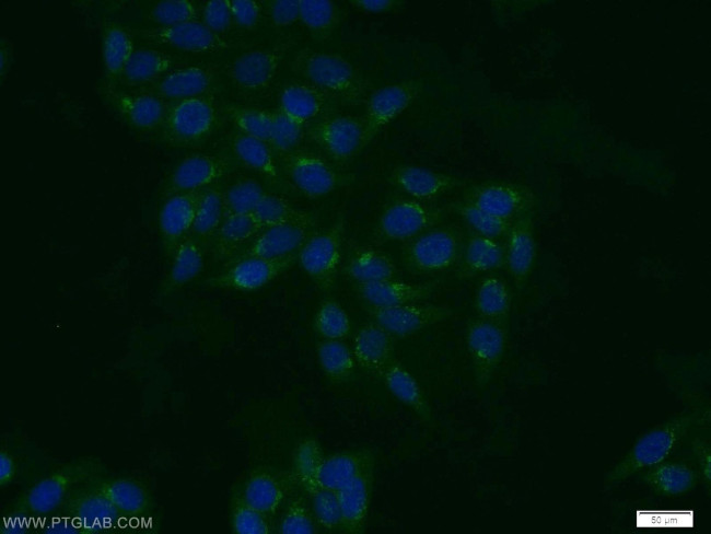 TBX5 Antibody in Immunocytochemistry (ICC/IF)