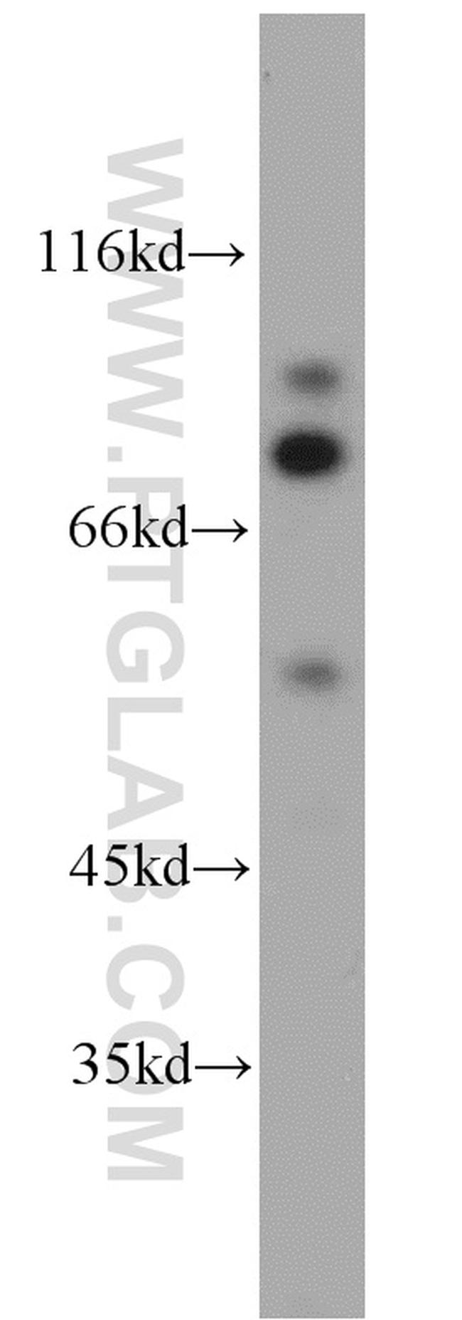 STAT5A Antibody in Western Blot (WB)