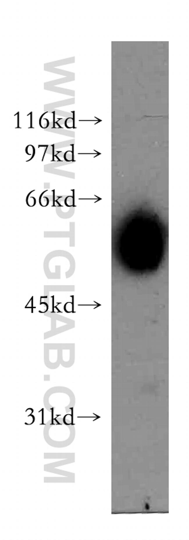 AKR7A3 Antibody in Western Blot (WB)