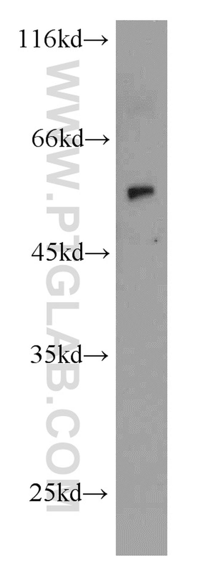CYP1A1 Antibody in Western Blot (WB)