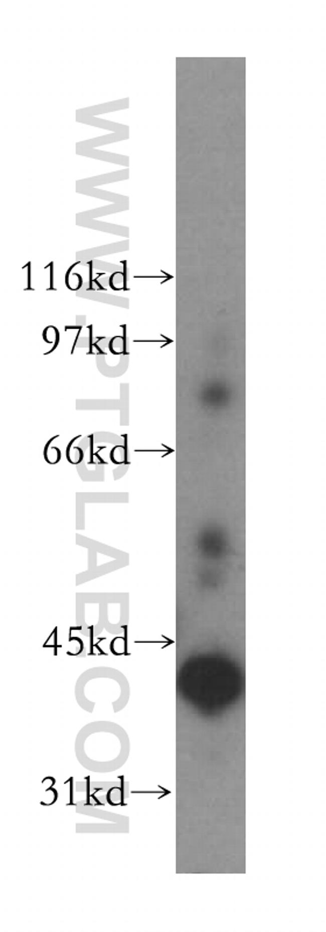 ADH6 Antibody in Western Blot (WB)