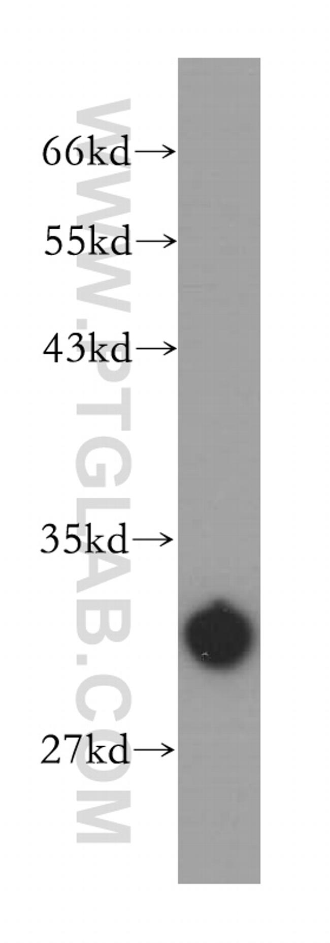 CA5B Antibody in Western Blot (WB)