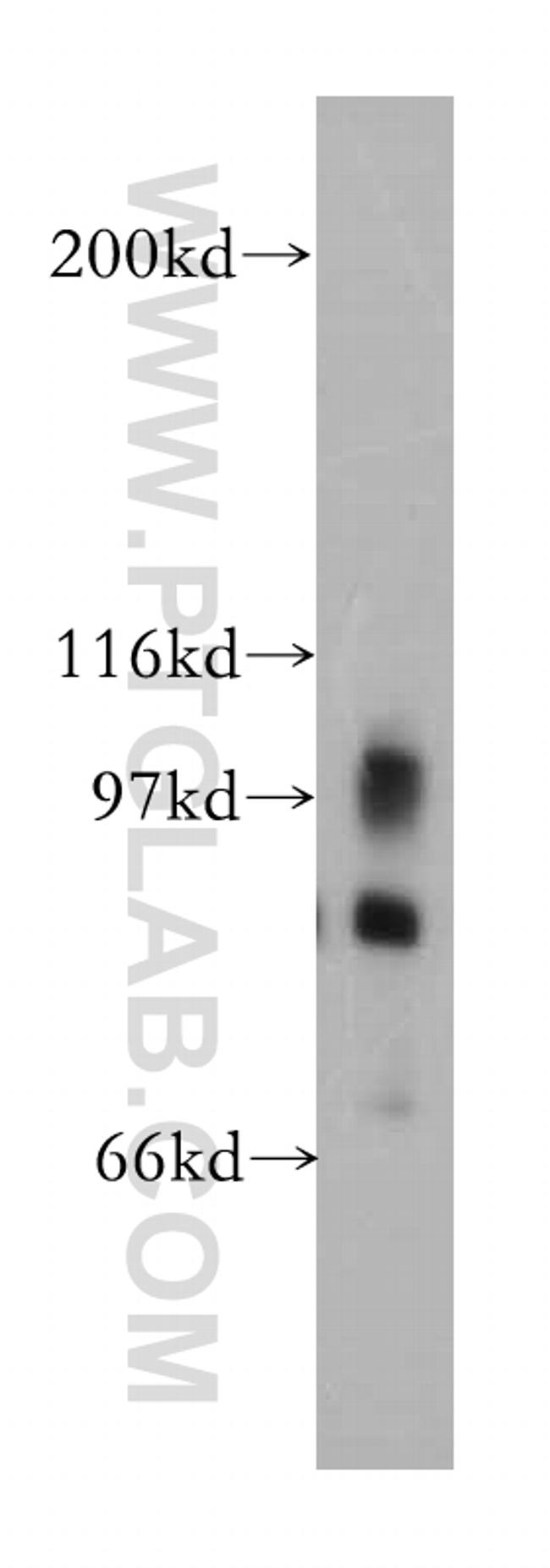 PLA2G4D Antibody in Western Blot (WB)