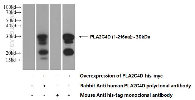 PLA2G4D Antibody in Western Blot (WB)
