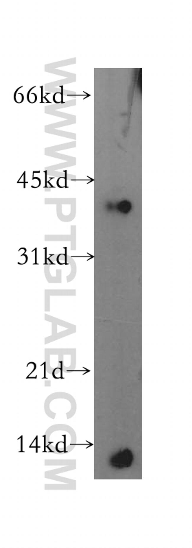 MIP-3-beta Antibody in Western Blot (WB)
