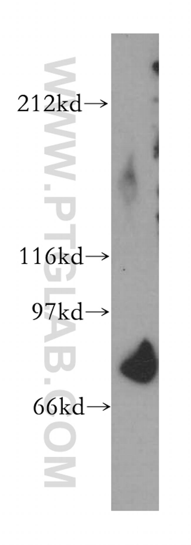 SFRS17A Antibody in Western Blot (WB)