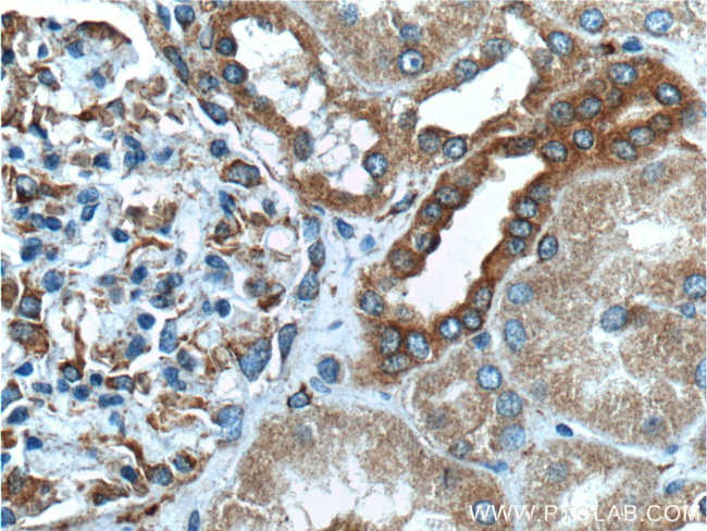 SYVN1 Antibody in Immunohistochemistry (Paraffin) (IHC (P))