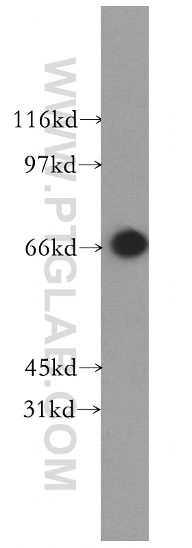 SYVN1 Antibody in Western Blot (WB)