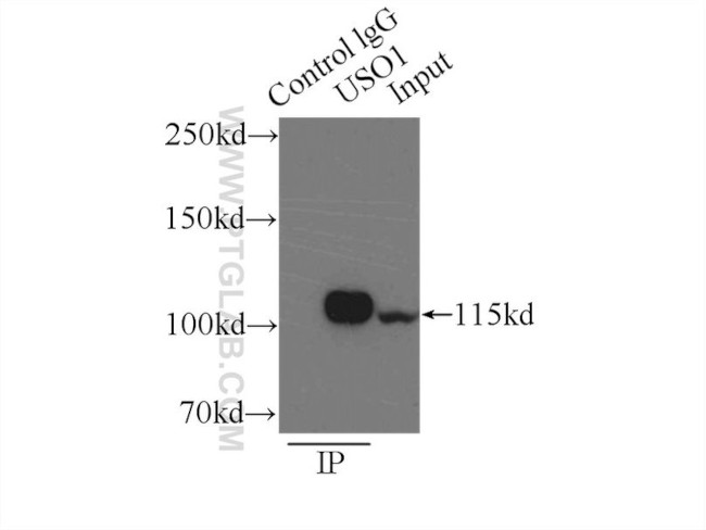 p115/USO1 Antibody in Immunoprecipitation (IP)