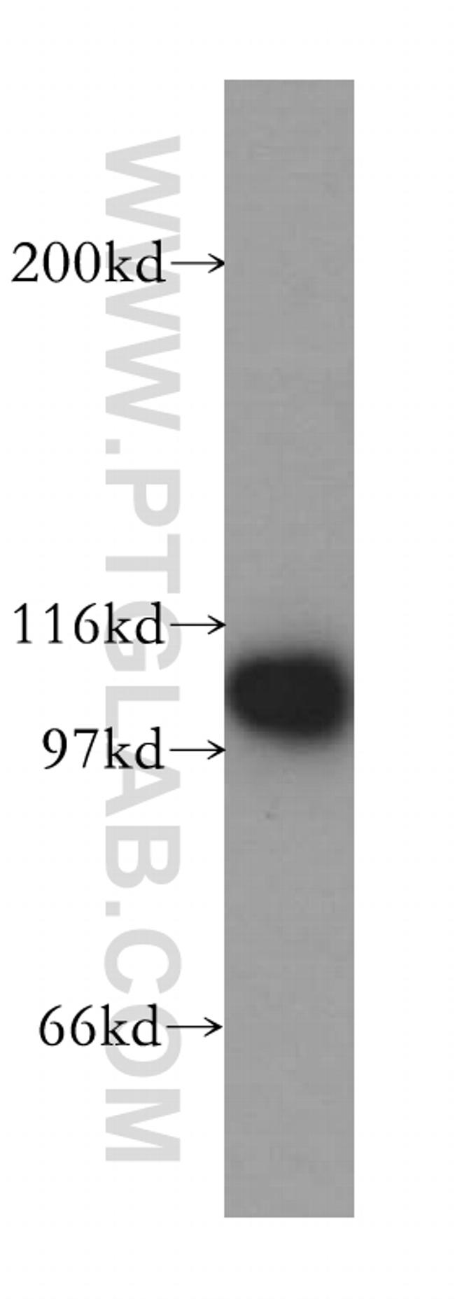 p115/USO1 Antibody in Western Blot (WB)