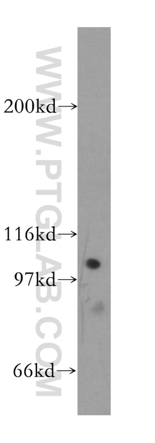 p115/USO1 Antibody in Western Blot (WB)