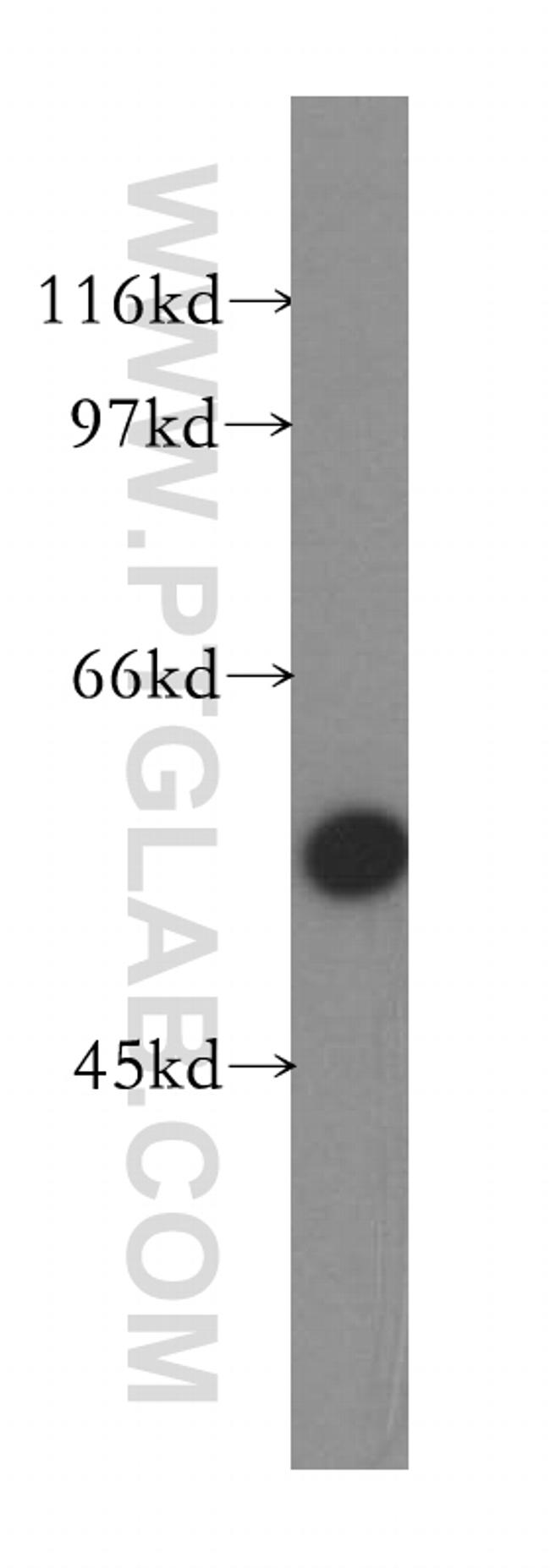 ZnT6 Antibody in Western Blot (WB)