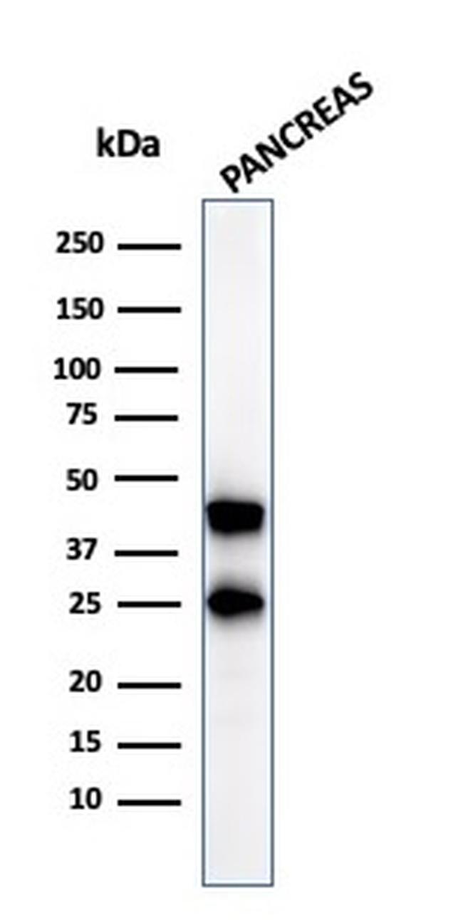 Carboxypeptidase A1/CPA1 Antibody in Western Blot (WB)