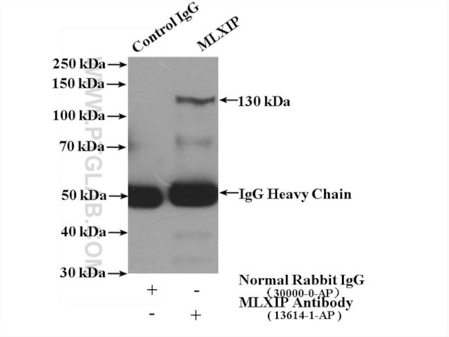 MLXIP Antibody in Immunoprecipitation (IP)