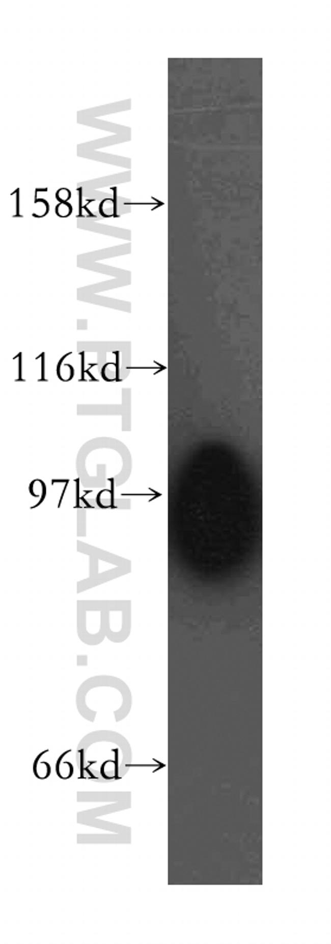 SERCA3 Antibody in Western Blot (WB)