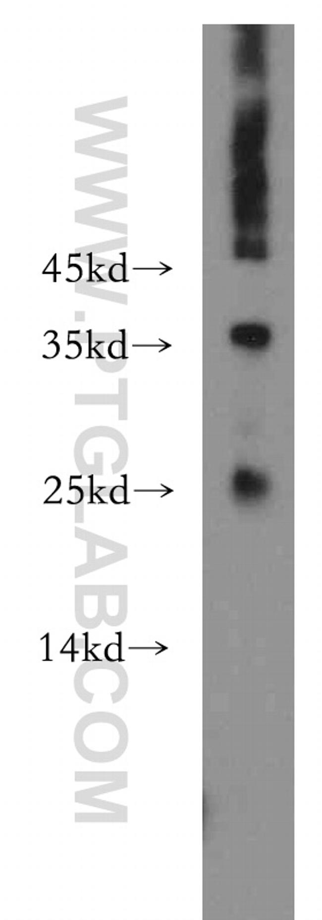 ADAT2 Antibody in Western Blot (WB)
