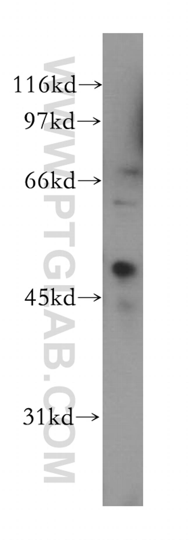 CREB3L4 Antibody in Western Blot (WB)