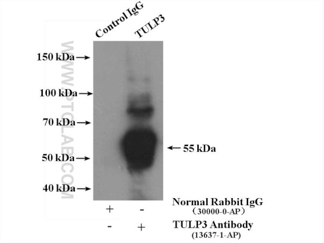 TULP3 Antibody in Immunoprecipitation (IP)
