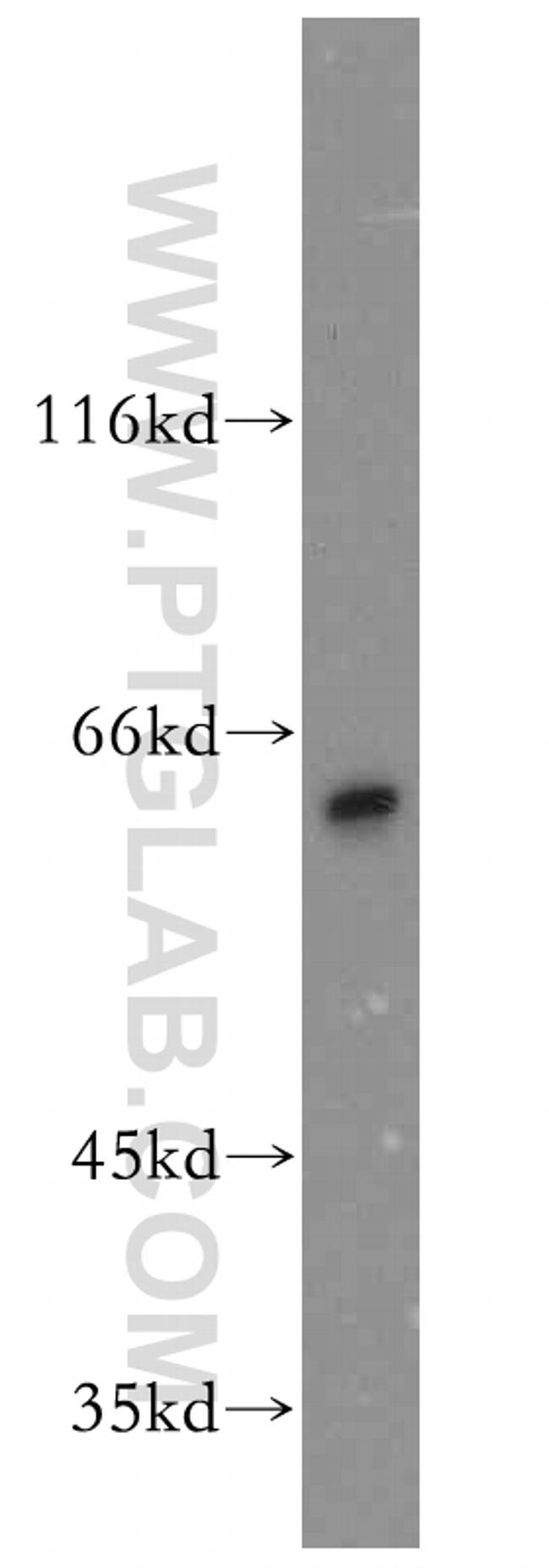 CRMP4 Antibody in Western Blot (WB)