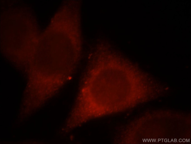 MPPED1 Antibody in Immunocytochemistry (ICC/IF)