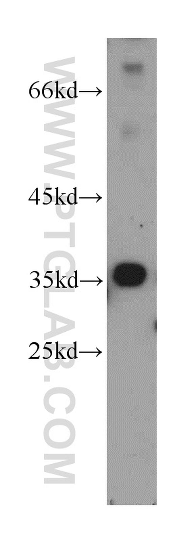 MPPED1 Antibody in Western Blot (WB)