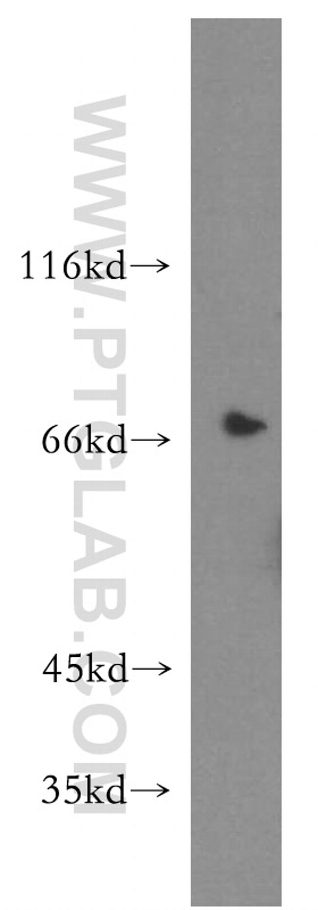 SLC9A9 Antibody in Western Blot (WB)