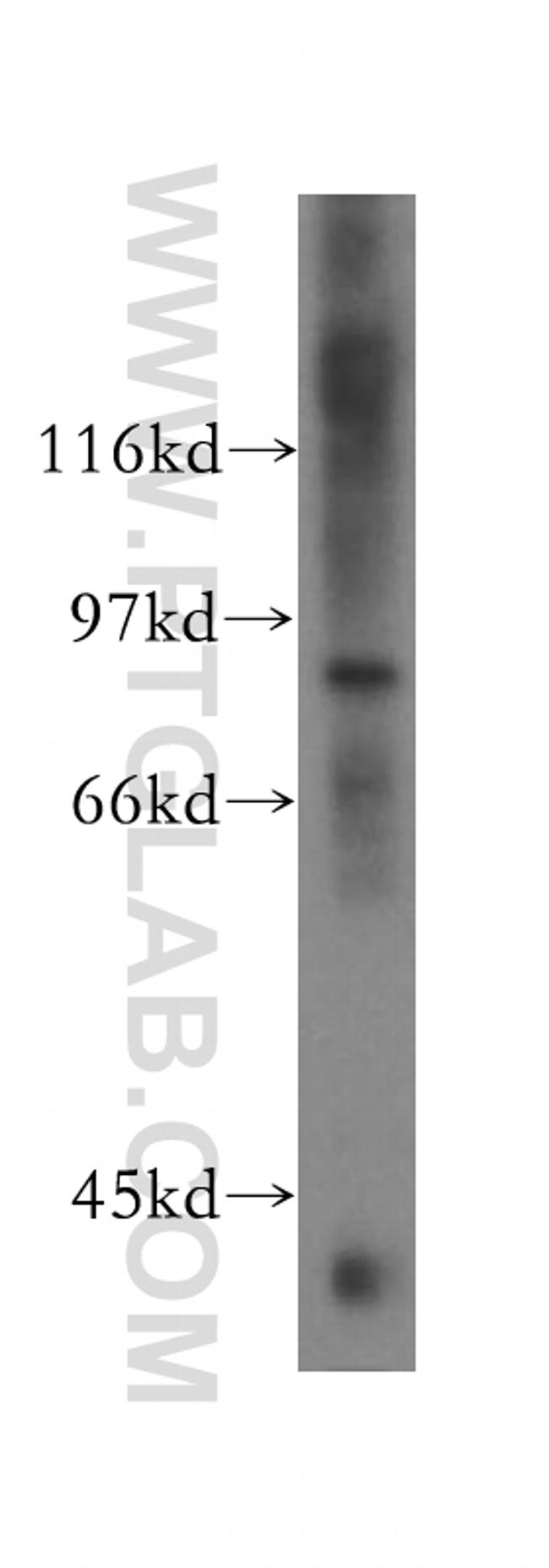 HCN3 Antibody in Western Blot (WB)