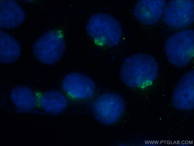 TRAK2 Antibody in Immunocytochemistry (ICC/IF)