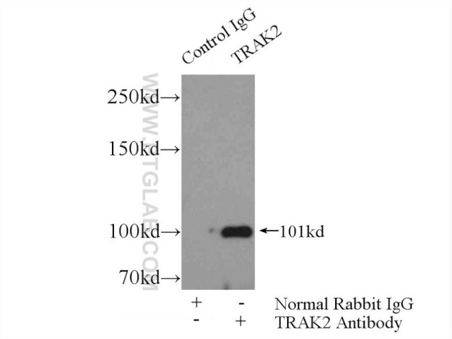 TRAK2 Antibody in Immunoprecipitation (IP)