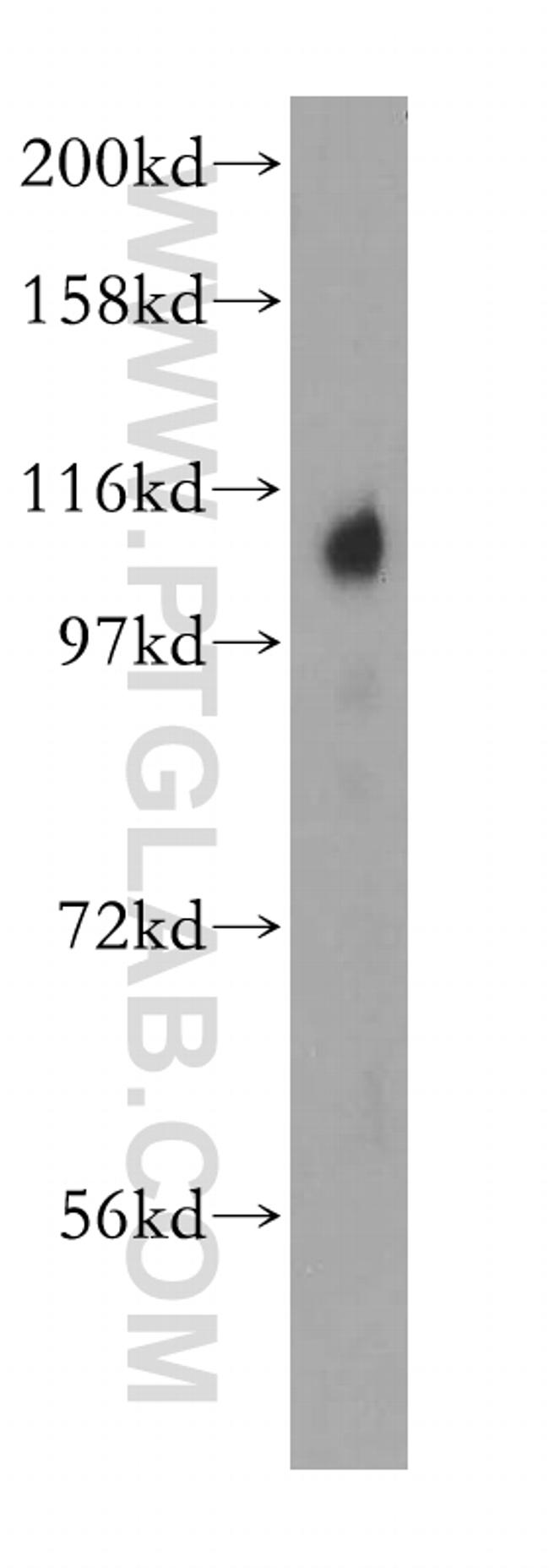 TRAK2 Antibody in Western Blot (WB)